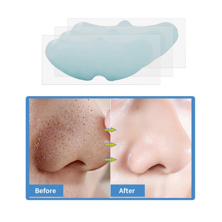 pore strips (9)